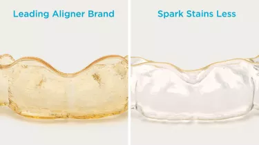 Spark Aligners reduced staining
