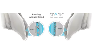 The science behind spark